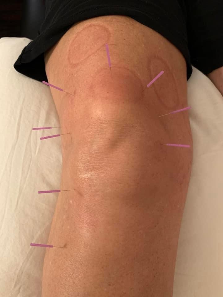 Cornerstone Wellness Center