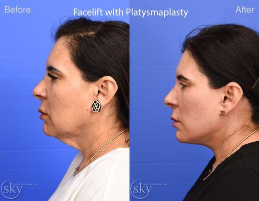 Sky Facial Plastic Surgery