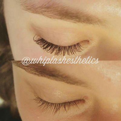 Whiplash Esthetics
