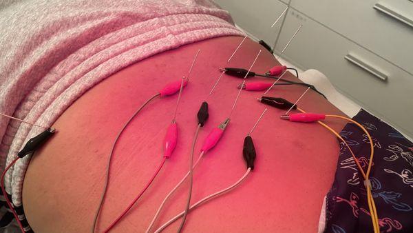 Traditional Acupuncture Clinic