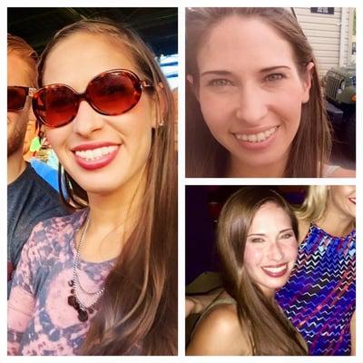 I was so nervous about having braces at 26, but Dr. Giordano found the perfect option for me! You can hardly notice them! Thank you Dr. G!