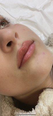 Lip blush- permanent lip tattoo 
Vegan pigments lushes lip contouring without fillers