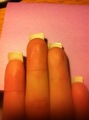 Drips that dried and I was told to fix myself at home