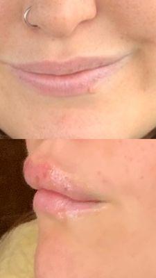 Kucumber Skin Lounge