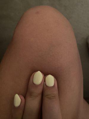 Middle finger and pointer finger are completely different lengths