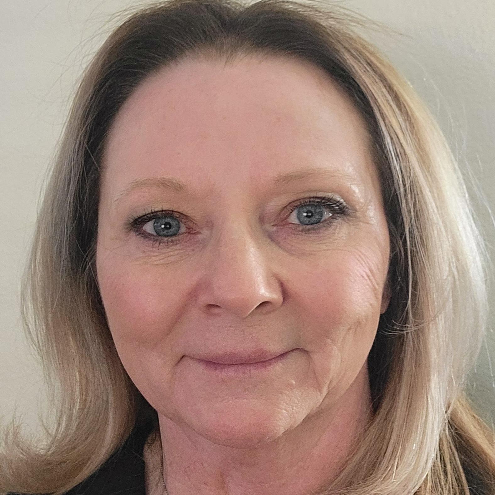 Karen Beers, FNP, BC