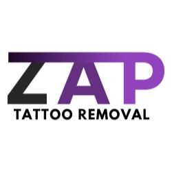 ZAP Tattoo Removal in Plano, TX