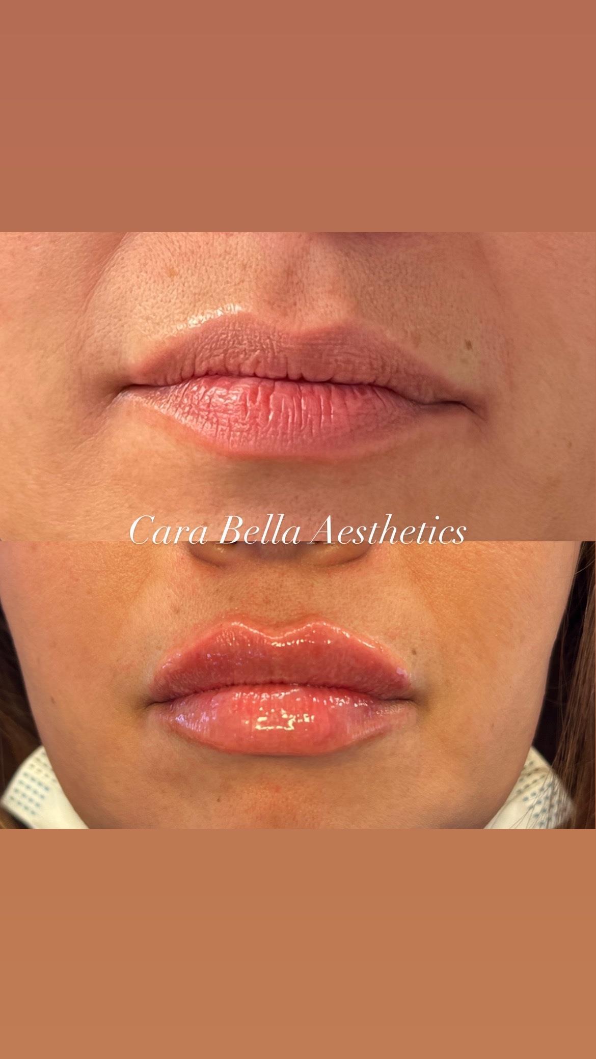 Cara Bella Aesthetics & Spa