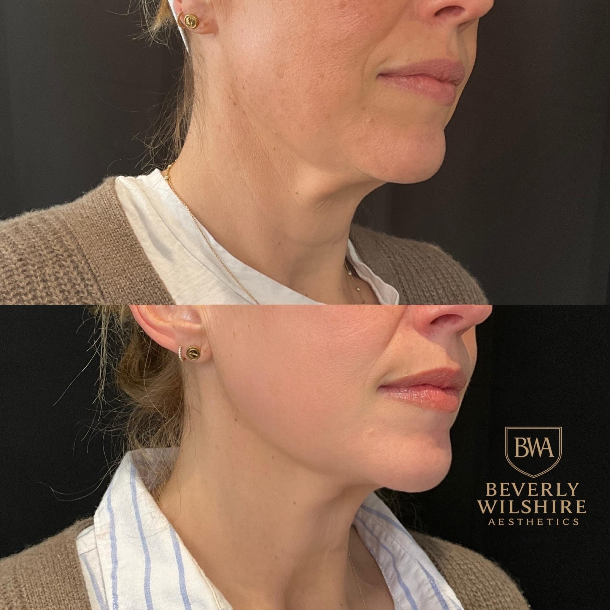 Beverly Wilshire Aesthetics Beverly Hills Medical Spa