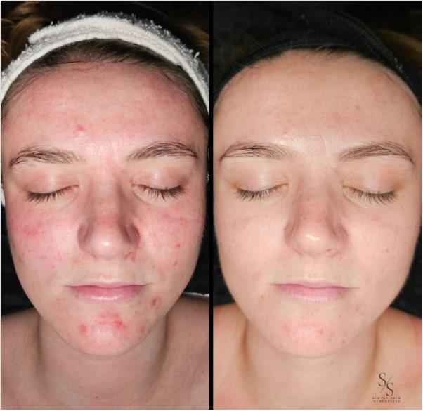 Simply Skin Aesthetics