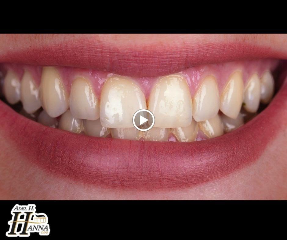 Adel H Hanna, DDS & Assoc.