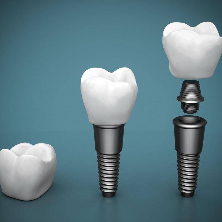 Kiwan Dental Care & Dental Implants Center