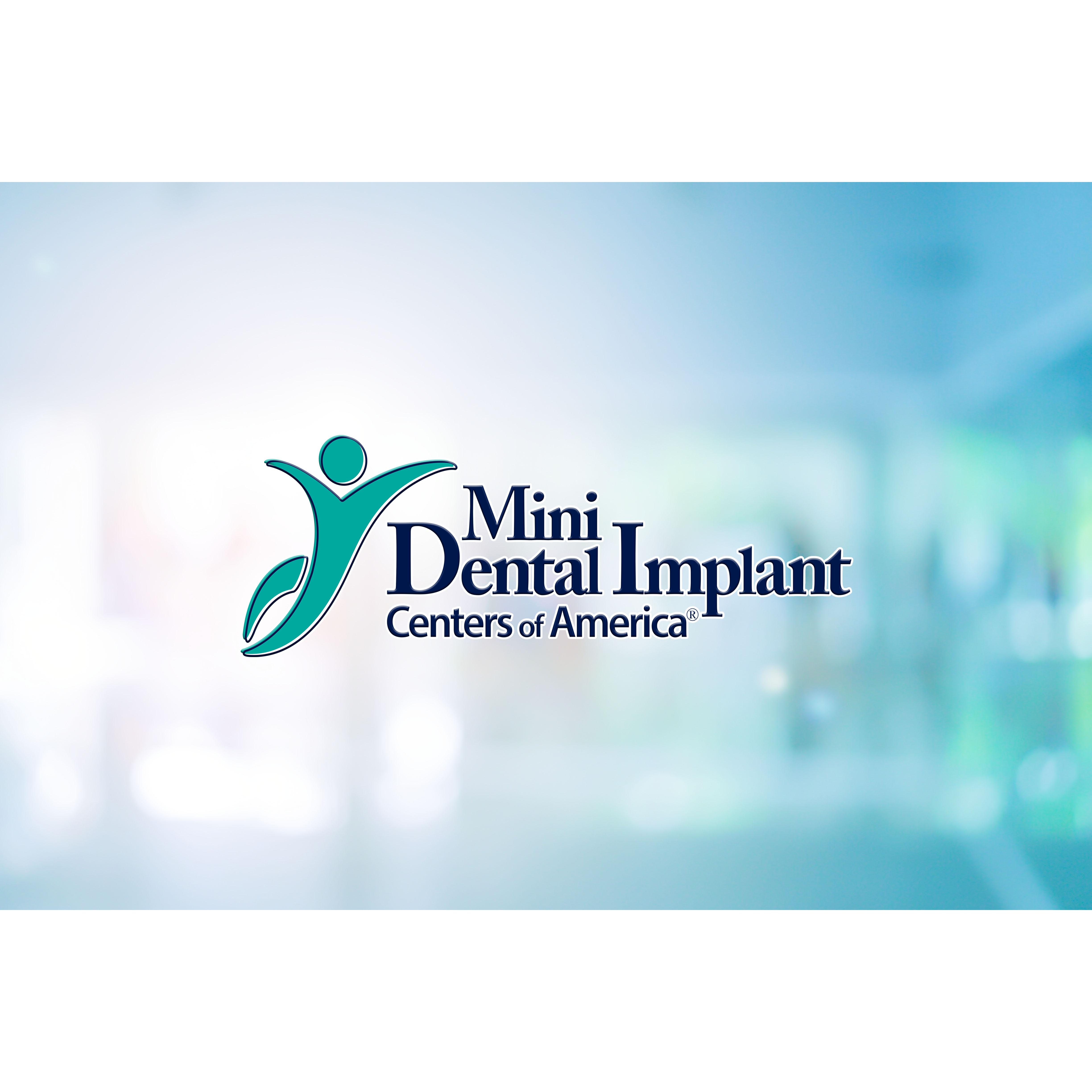 Mini Dental Implants