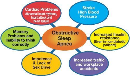 Sleep Apnea Center of Los Angeles