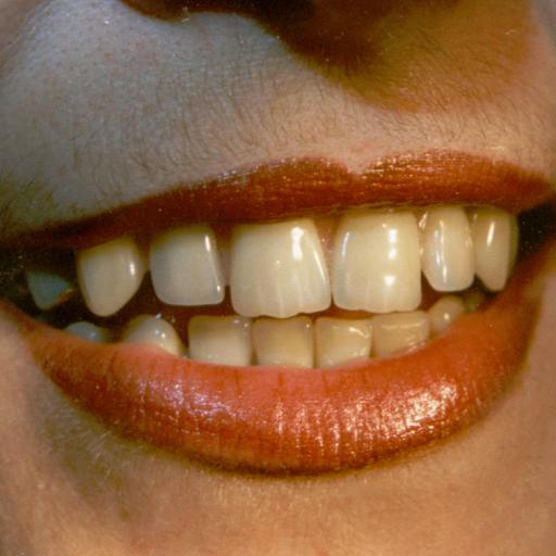 Paul Bernard denturologiste - Sainte-Foy, Cap-Rouge, Sillery, Ancienne Lorette