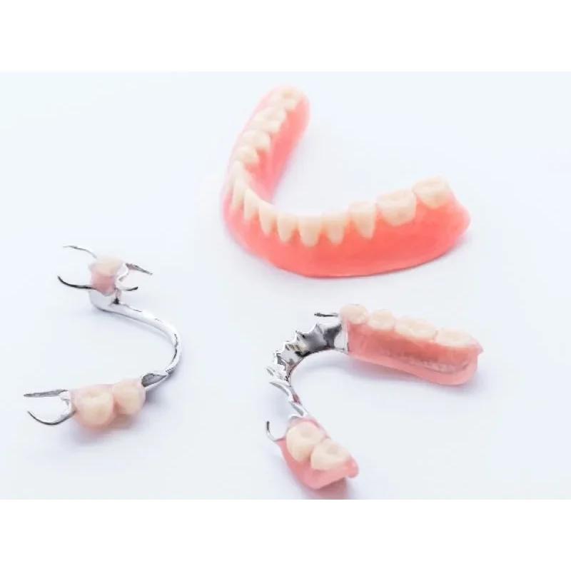 Chrome Cast Dental Laboratory