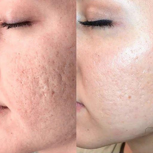 Athena Body Sugaring Spa