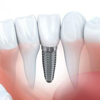 Wayman Family and Cosmetic Dentistry