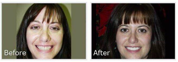 Dr Steven W Haywood Exceptional Dental Care