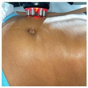Siluhwetz Body Contouring