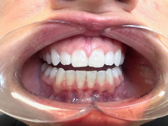 Jessica Desouza DDS Jdental