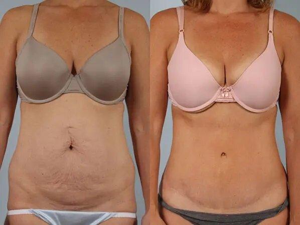 Spiro Plastic Surgery-Scott A Spiro, MD, FACS