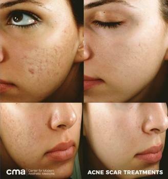 CMA - Center for Modern Aesthetic Medicine