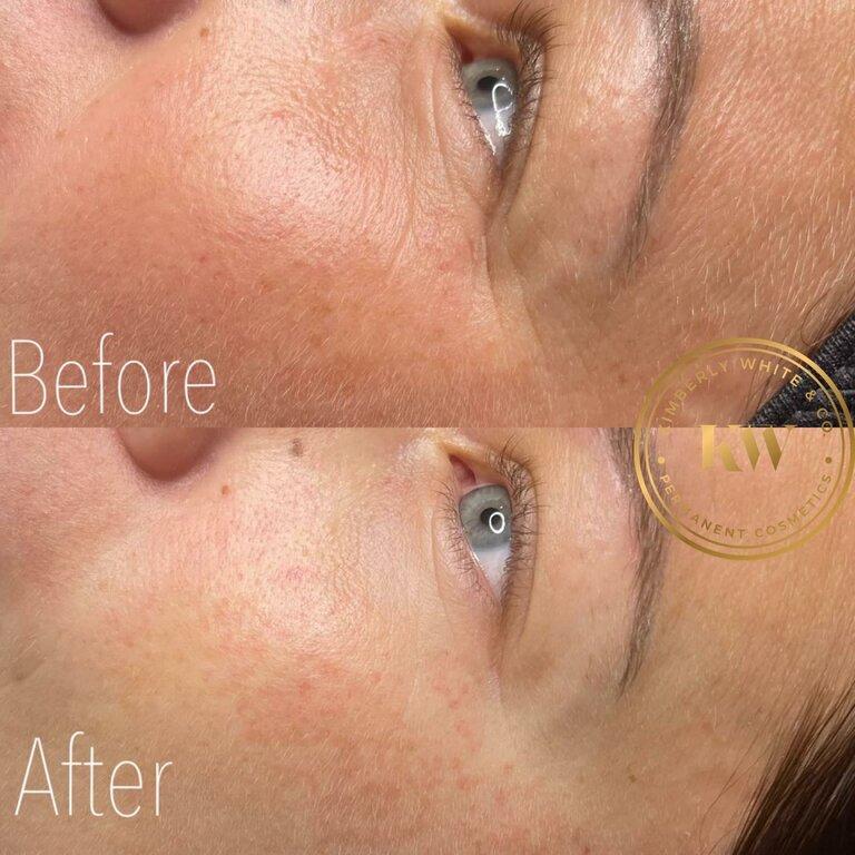 Kimberly White & Co Permanent Cosmetics