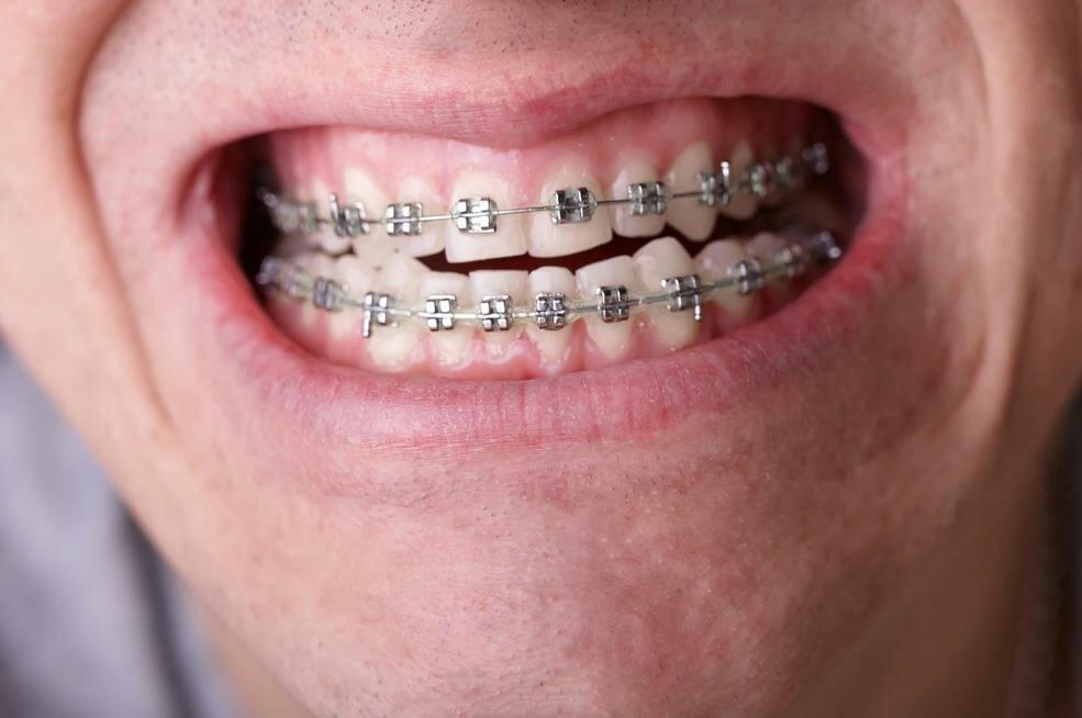 Alan Ferguson, D.D.S, P.L.C