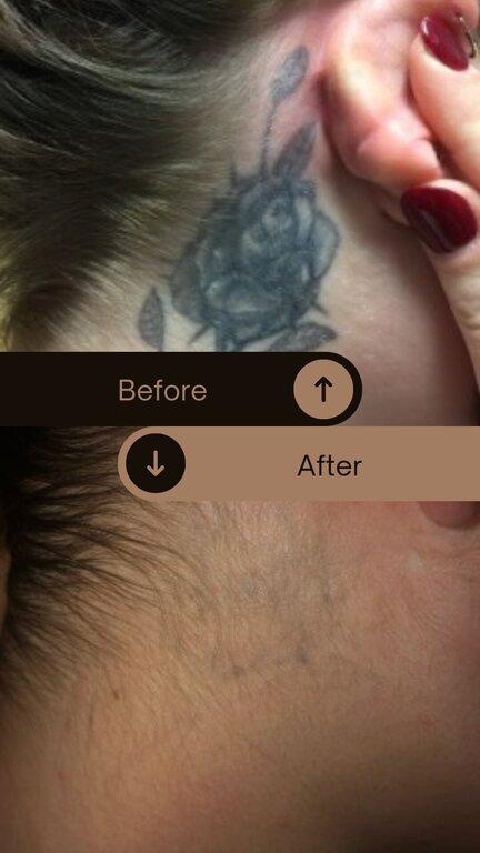 Disappearing Ink/ Jill & Bonnie's Hair Removal and Skin Clinic/ the Finished Line Permanent Cosmetics