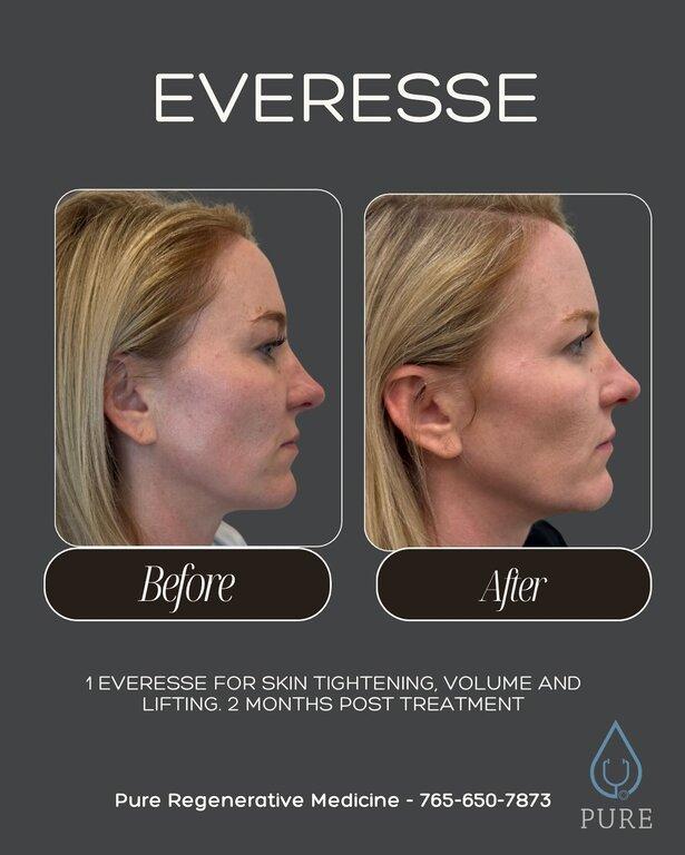 Pure Regenerative Medicine LLC