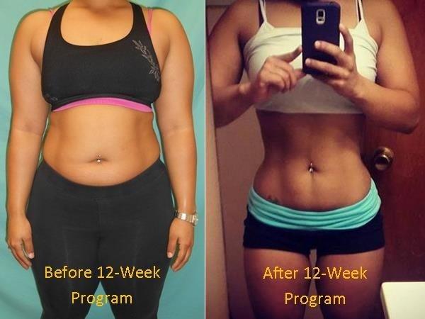 Health Fit M.D. Aesthetics, Wellness & Weight Loss