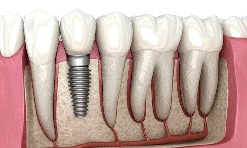 Park Ave Cosmetic Dentistry