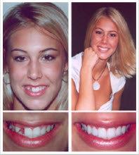 Springdale Family Dental