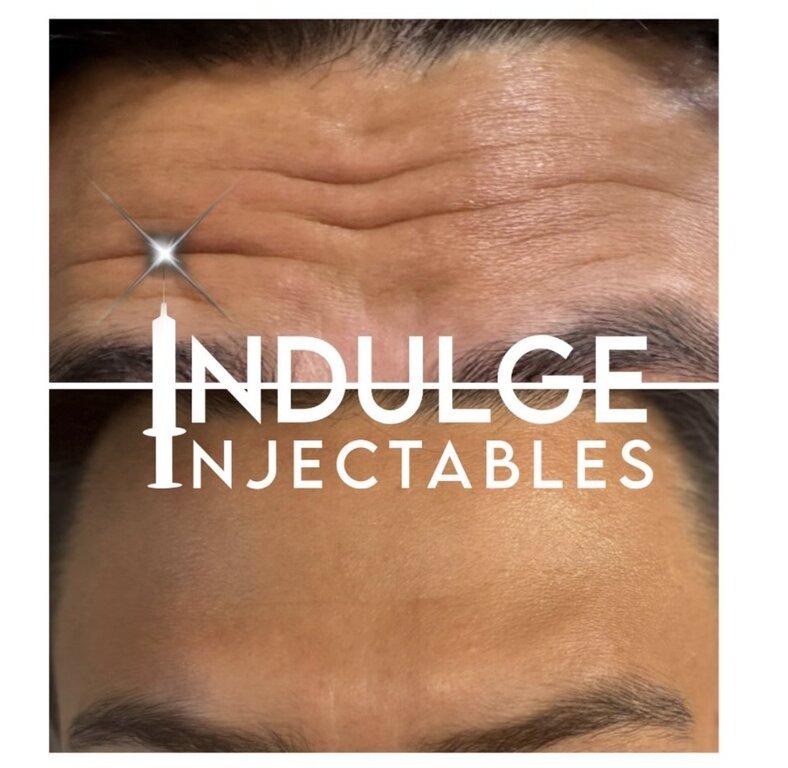 Indulge Injectables
