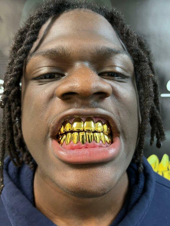 GoldManzoe