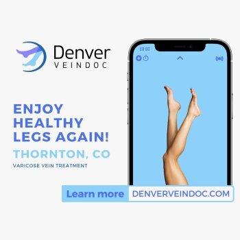 Denver Vein Doc-Thornton