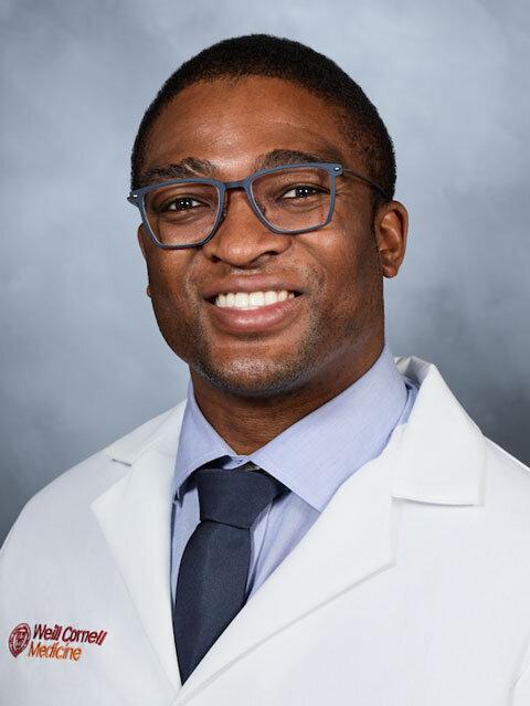 Chukwuma Onyebeke, MD - Weill Cornell Medicine