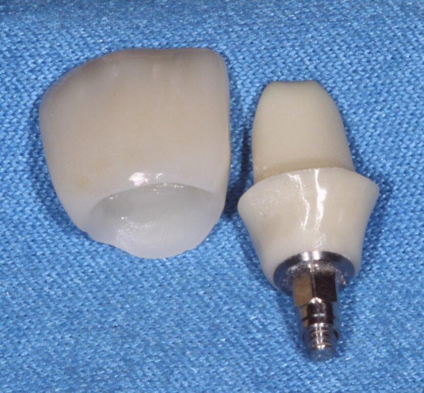 Stewart Dental Cadlab Research