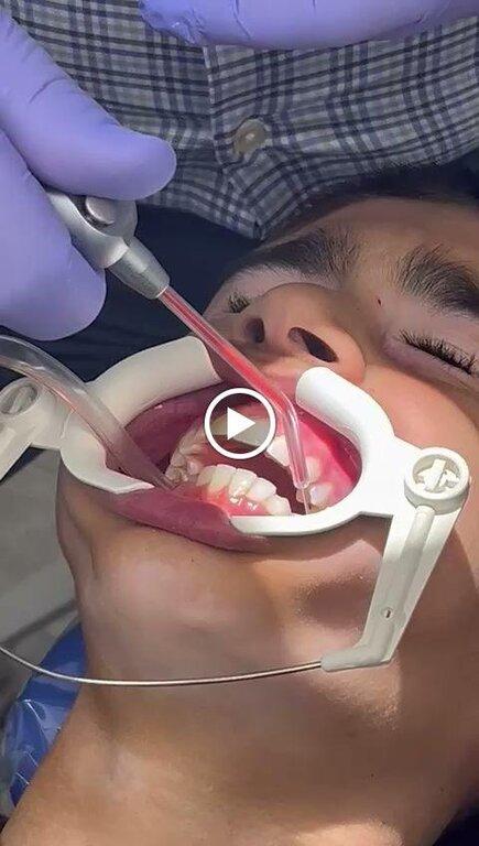 BP Smiles Orthodontics-Boris Pinhasov DDS Braces & Invisali