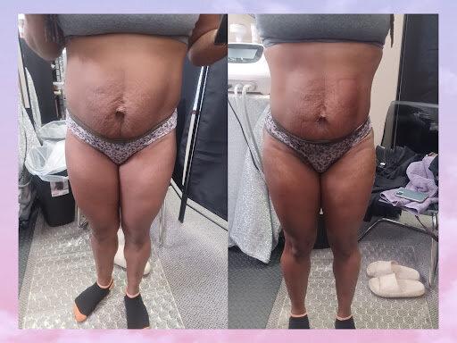 Total Image Master Body Sculpting