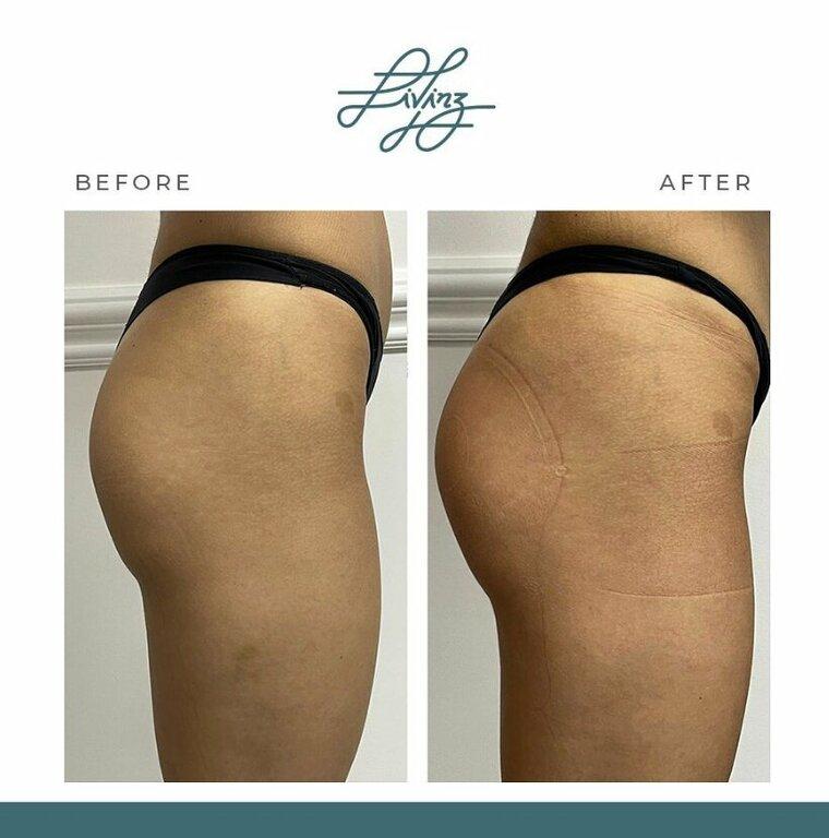 Livinz Medspa