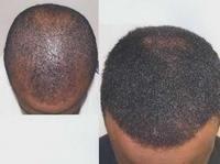 Ancient Hair Secrets