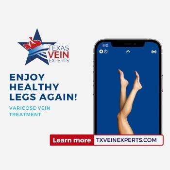 Texas Vein Experts