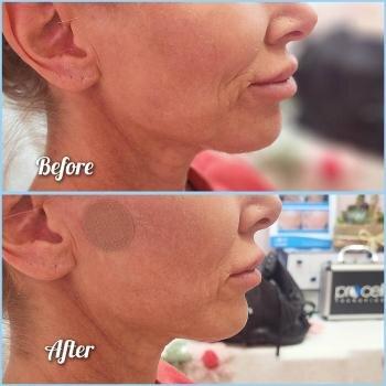 Happy Juice IV and Beauty