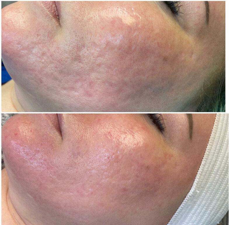 Affinity Day Spa and Permanent Cosmetics