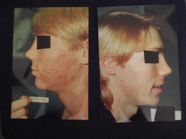 Advanced Dermatology of Newport Beach