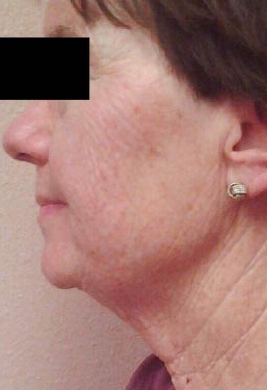 Elite Body Contouring Tupelo