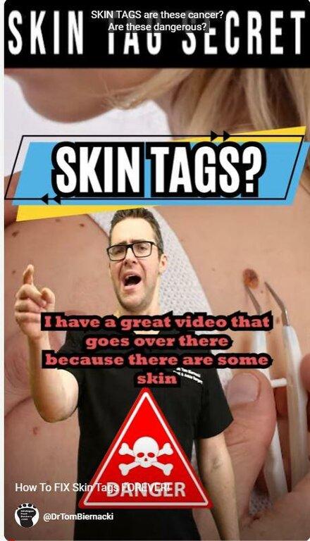 Tom Biernacki, DPM - Balance Foot & Ankle