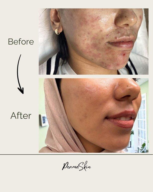 Permaskin Beauty Center & Academy